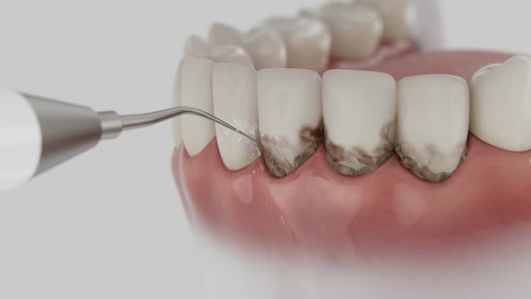 Reliable Dental contractor in Georgetown, IN by Dentist Open Now